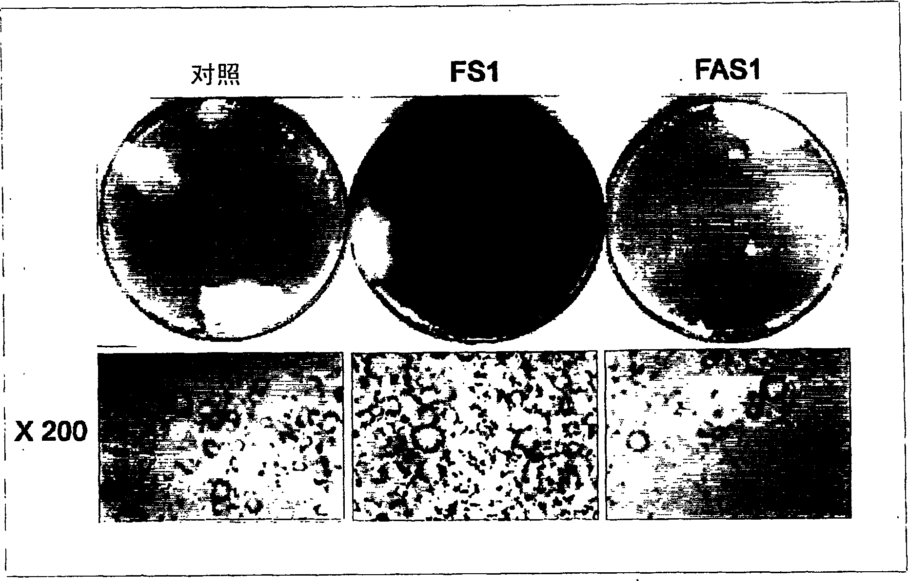 Isocitrate dehydrogenase, gene thereof, and use of the same in the treatment of obesity, hyperlipidemia, and fatty liver in lipid biosynthesis