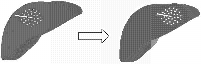 Simulation Method of Soft Tissue Deformation Based on Meshless Galerkin and Particle Spring Coupling