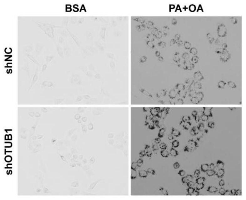 Application of ubiquitin aldehyde-binding protein 1 containing otu functional domain in the preparation of drugs for treating fatty liver and related diseases