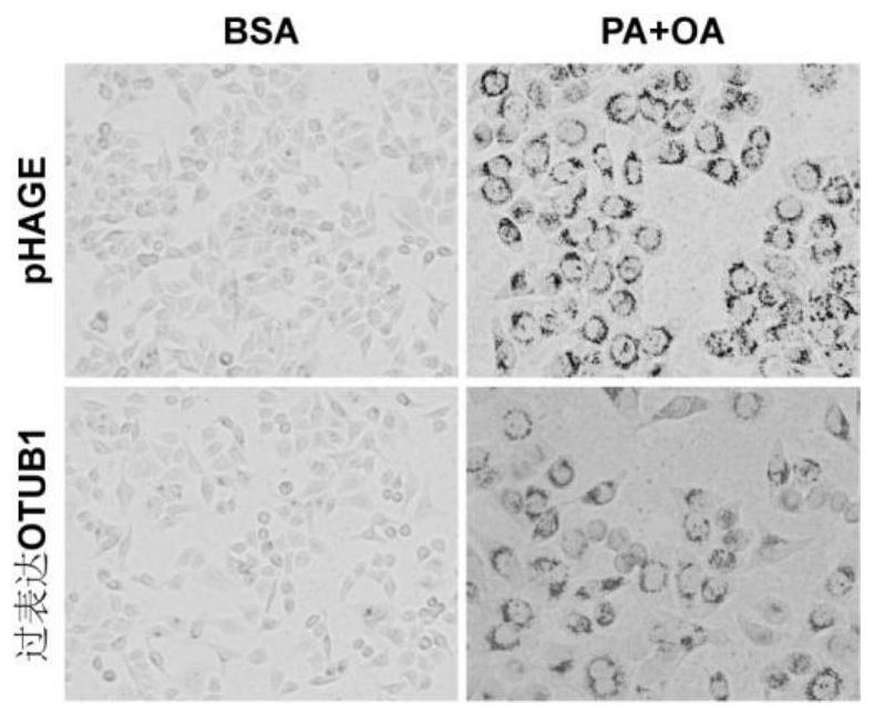 Application of ubiquitin aldehyde-binding protein 1 containing otu functional domain in the preparation of drugs for treating fatty liver and related diseases