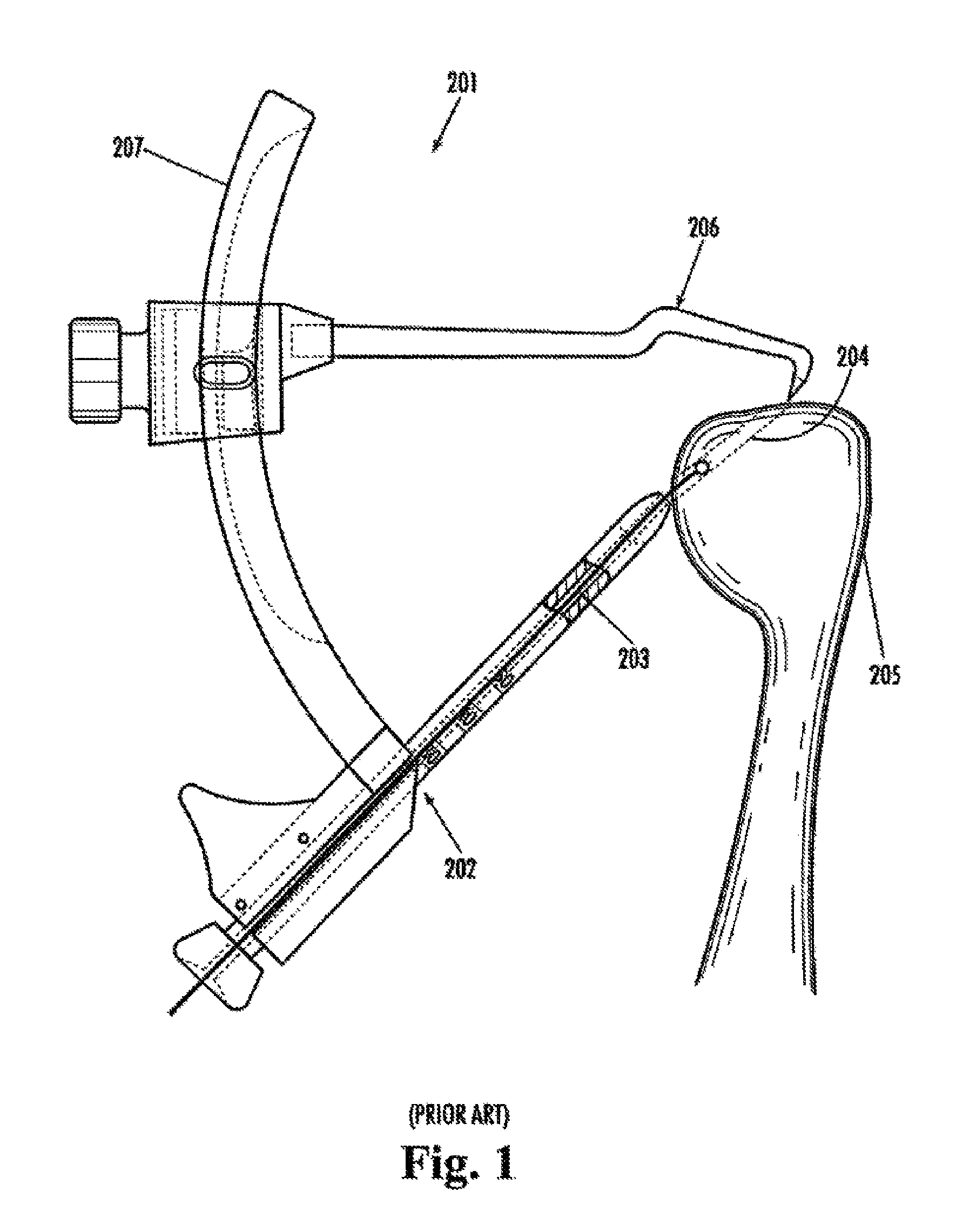 Method for drilling enlarged sections of angled osteal tunnels