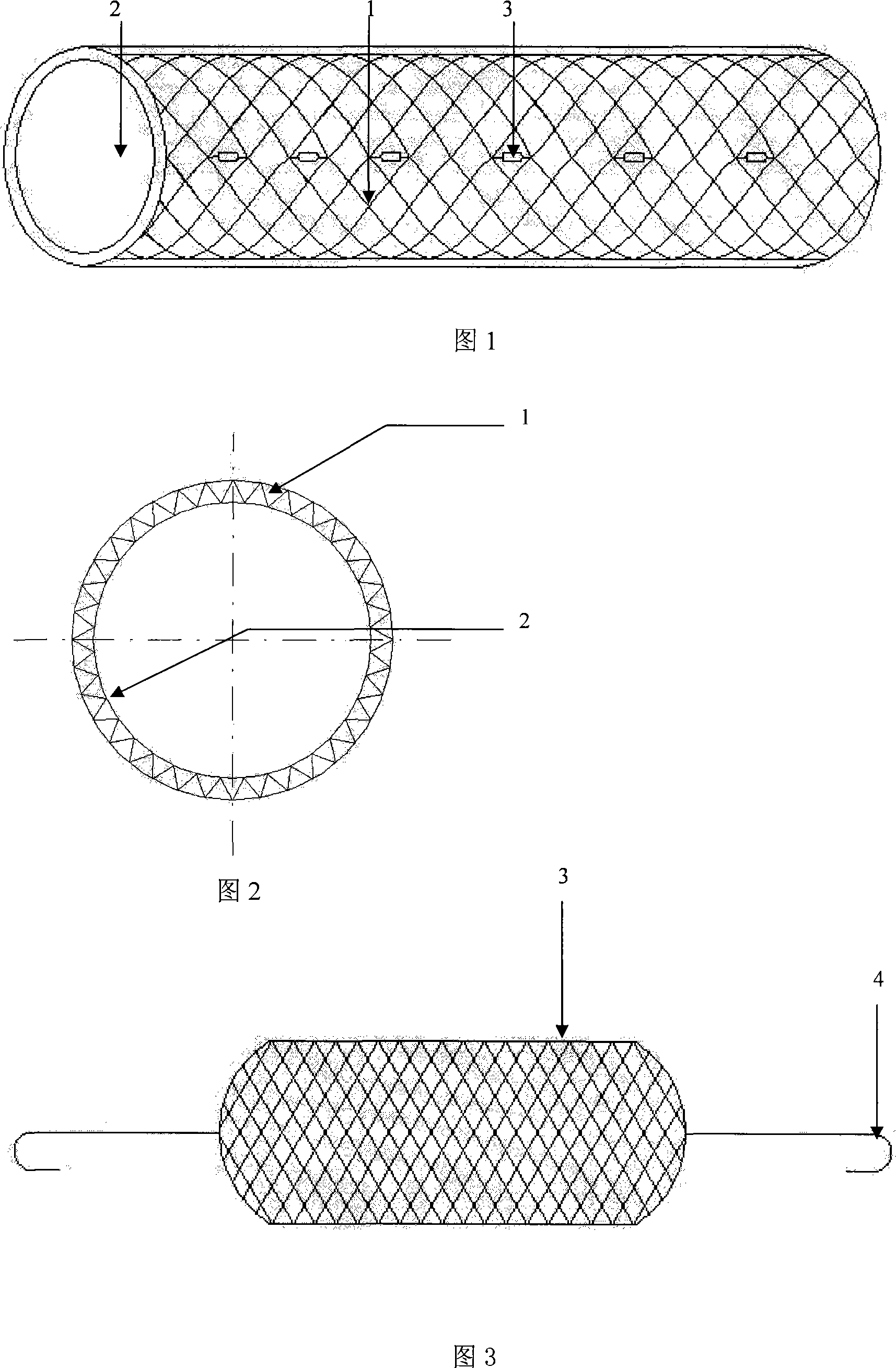 Medical tectorial membrane shaped radiation NiTi alloy endovascular stent