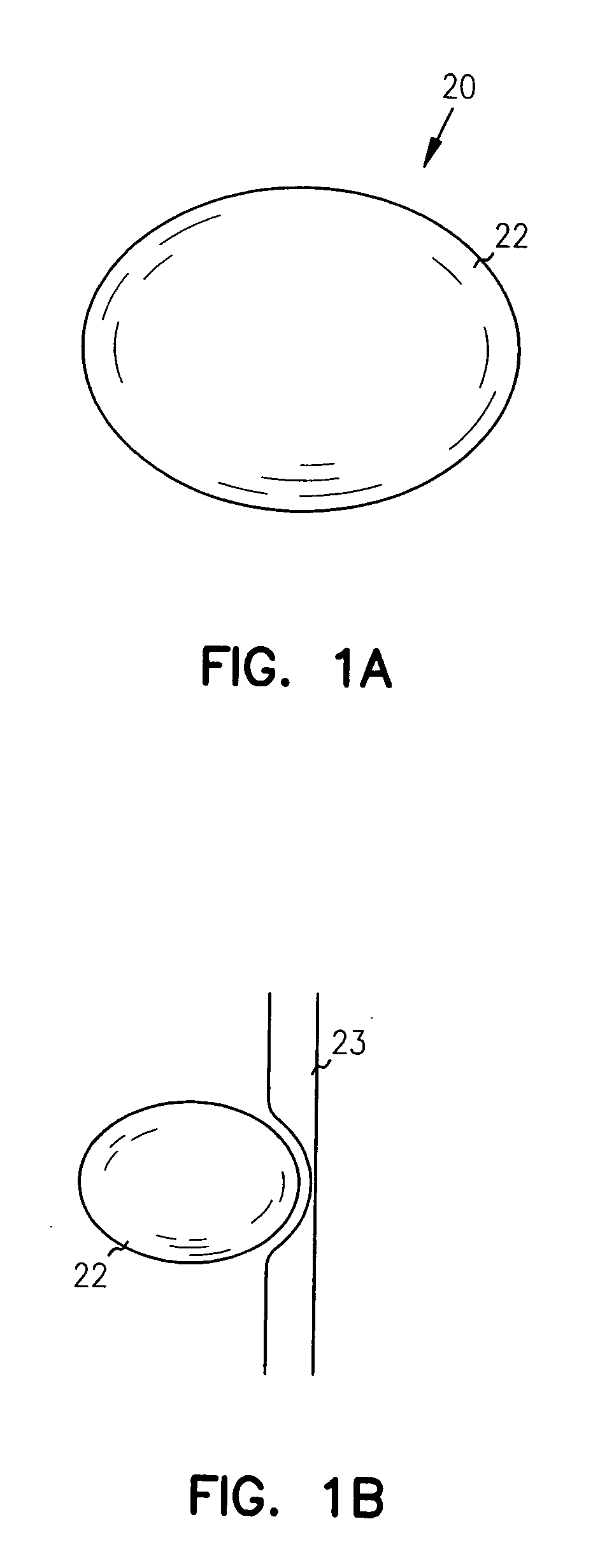 Adjustable implantable genitourinary device