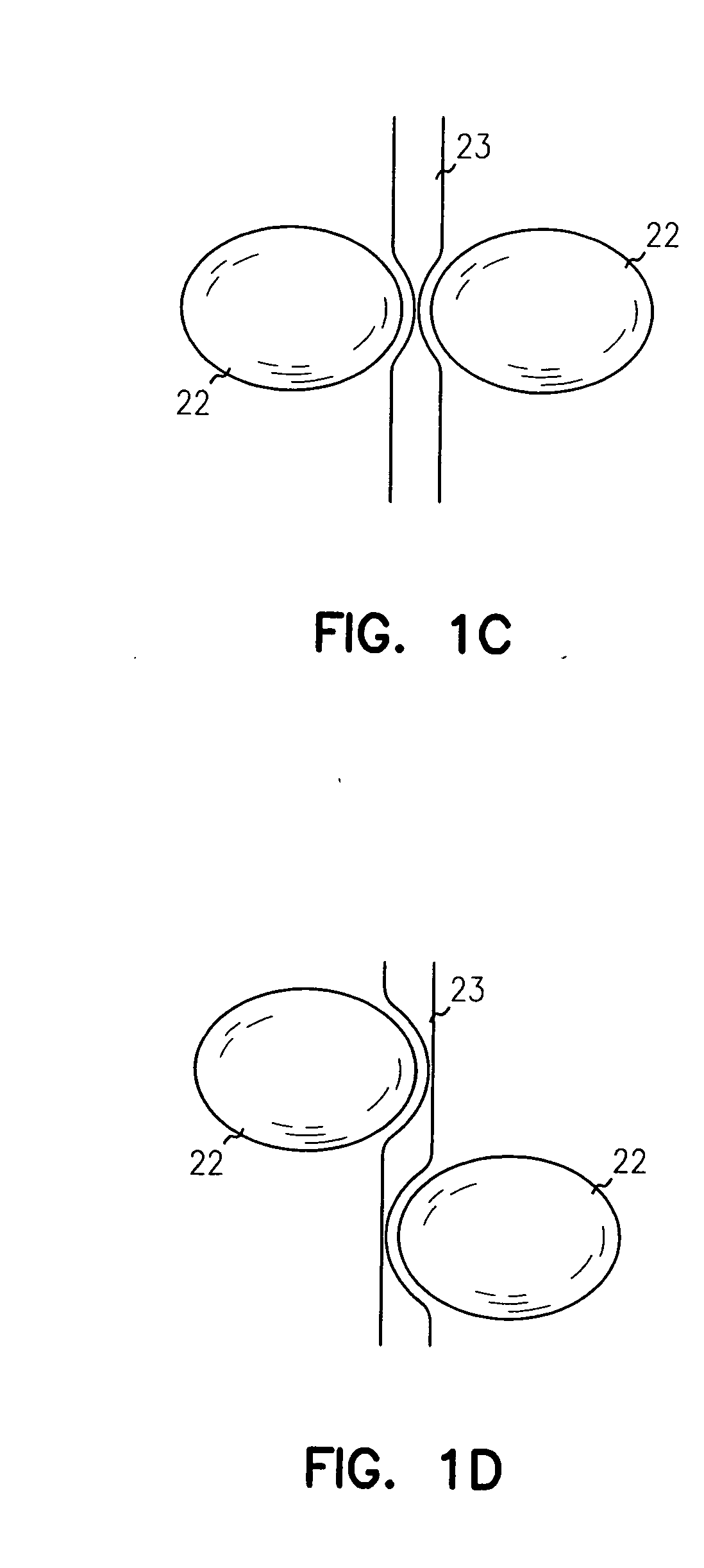 Adjustable implantable genitourinary device