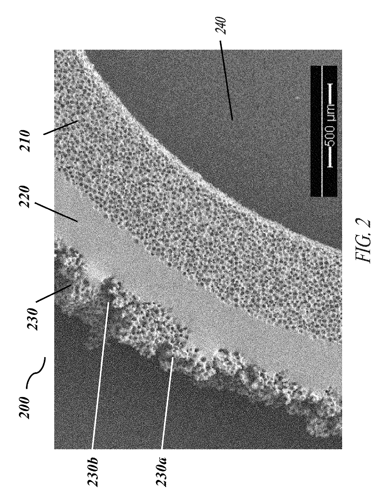 Corrugated microporous tissue interface for improved performance and infection resistance of vascular grafts and other implantable devices