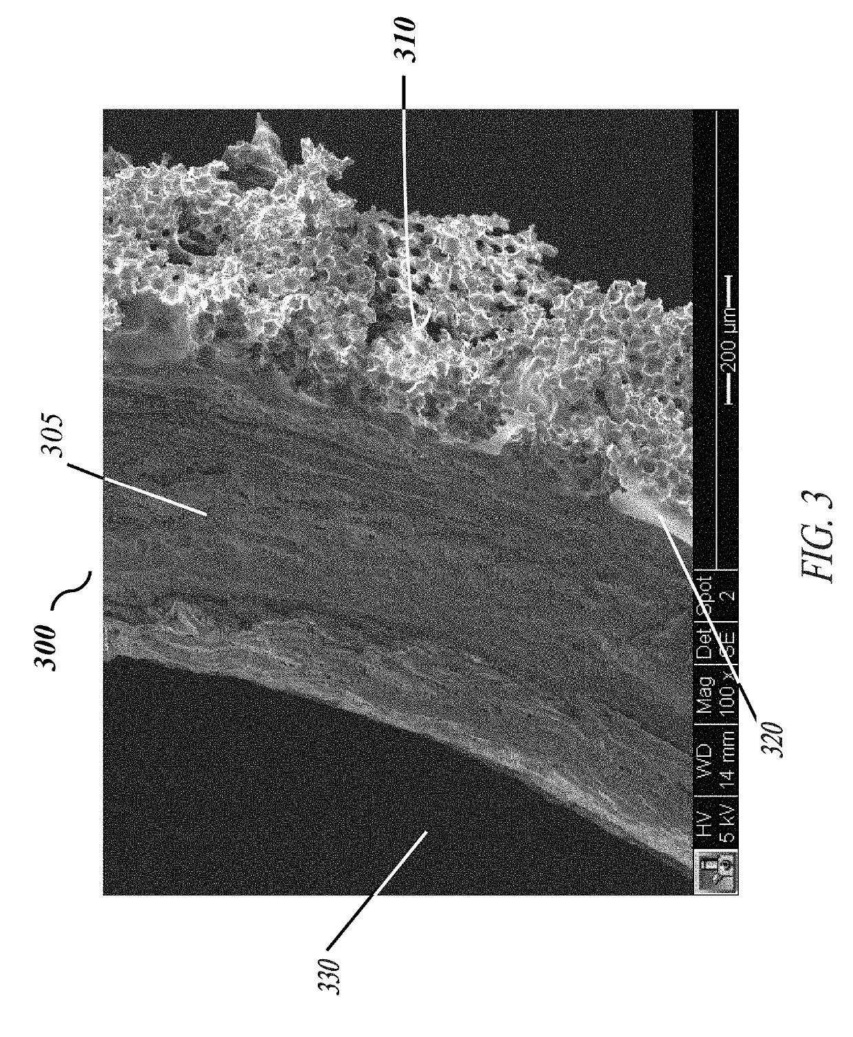 Corrugated microporous tissue interface for improved performance and infection resistance of vascular grafts and other implantable devices