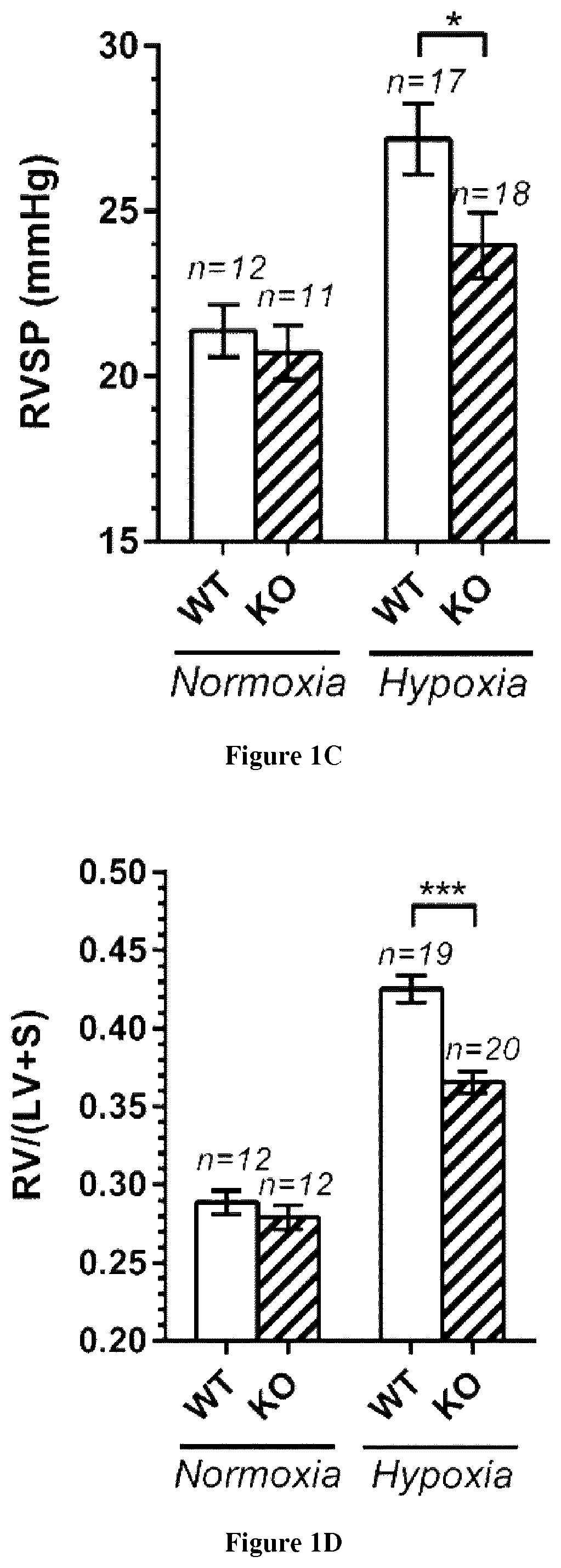 NMDAR antagonists for the treatment of diseases associated with angiogenesis