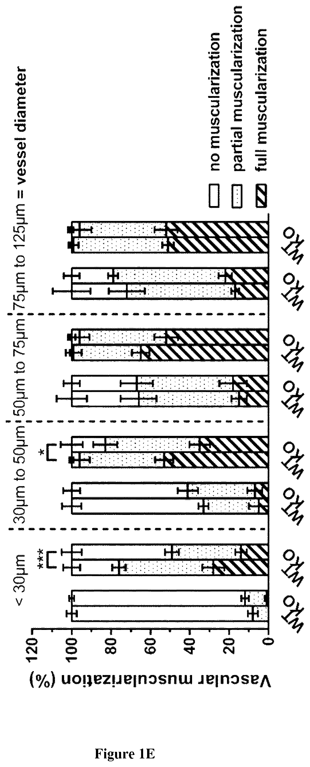 NMDAR antagonists for the treatment of diseases associated with angiogenesis