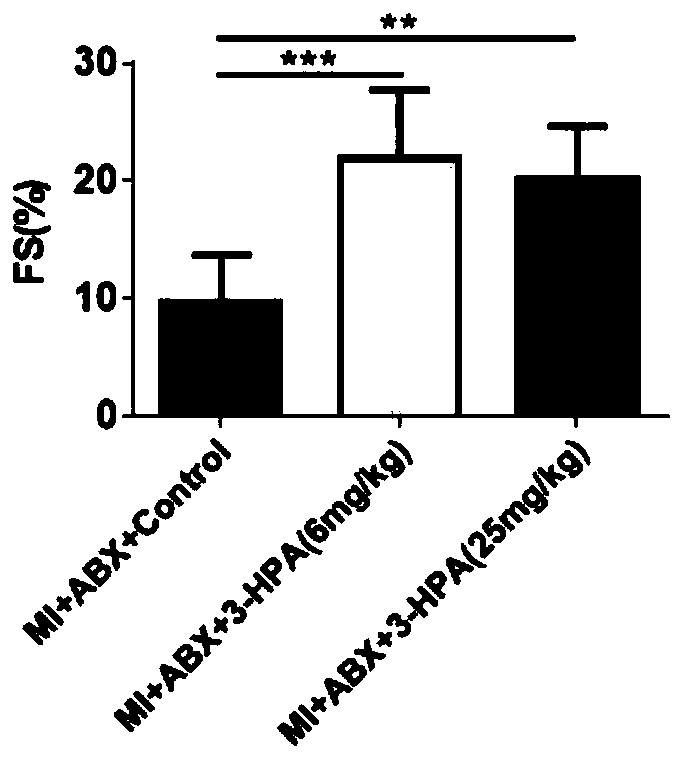 Application of 3-hydroxyphenylacetic acid (3-HPA) in preparation of drug for improving ventricular pathological reconstruction and/heart failure after myocardial infarction