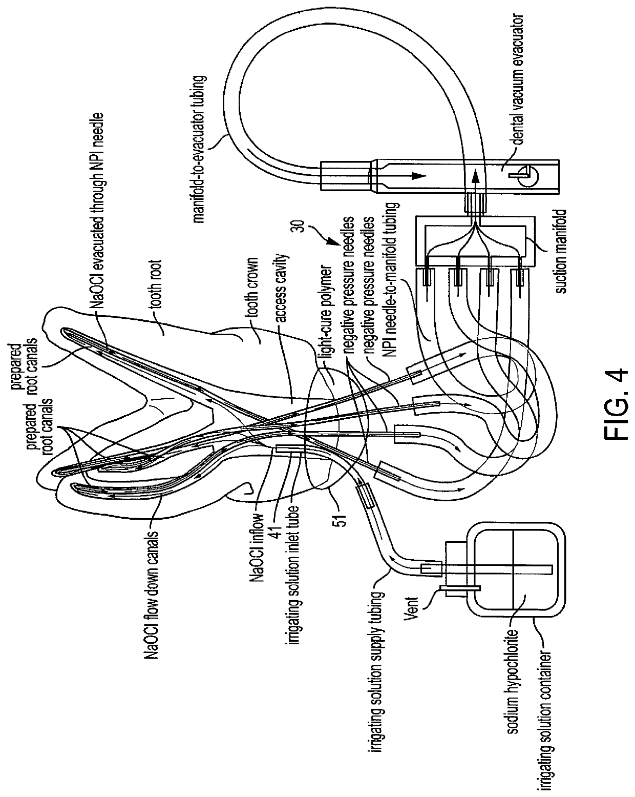 Multi-cannula negative pressure irrigation system