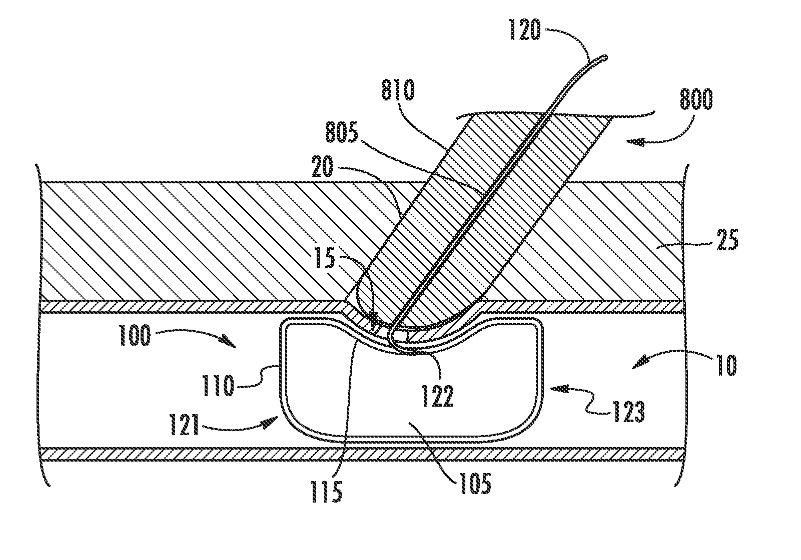 Vasculature closure devices and methods