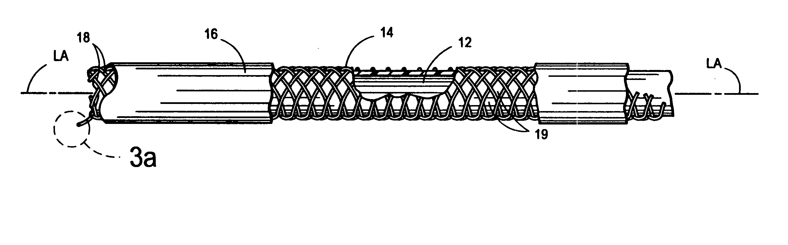 Polymer coated stents