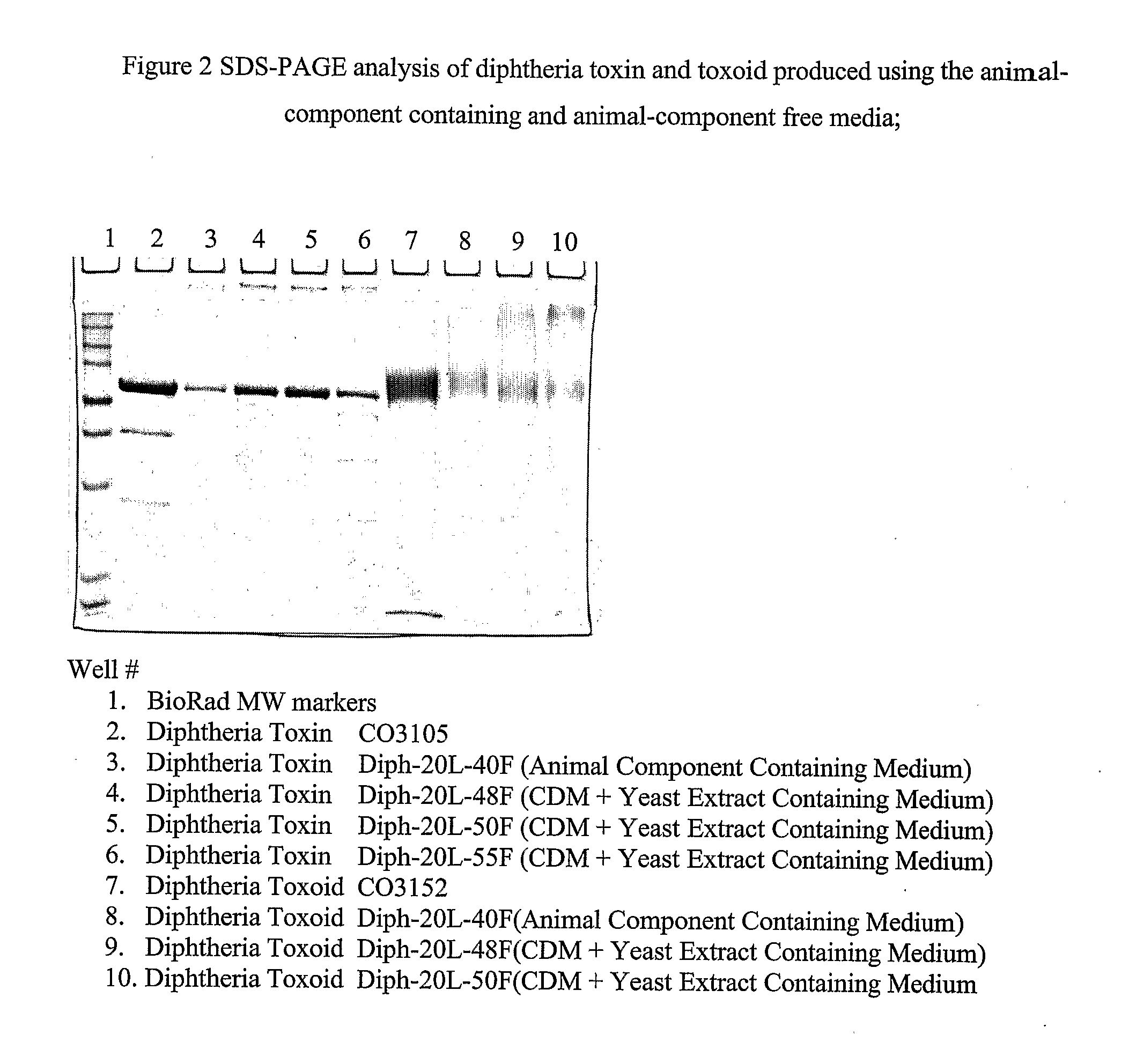 Production of diphtheria toxin