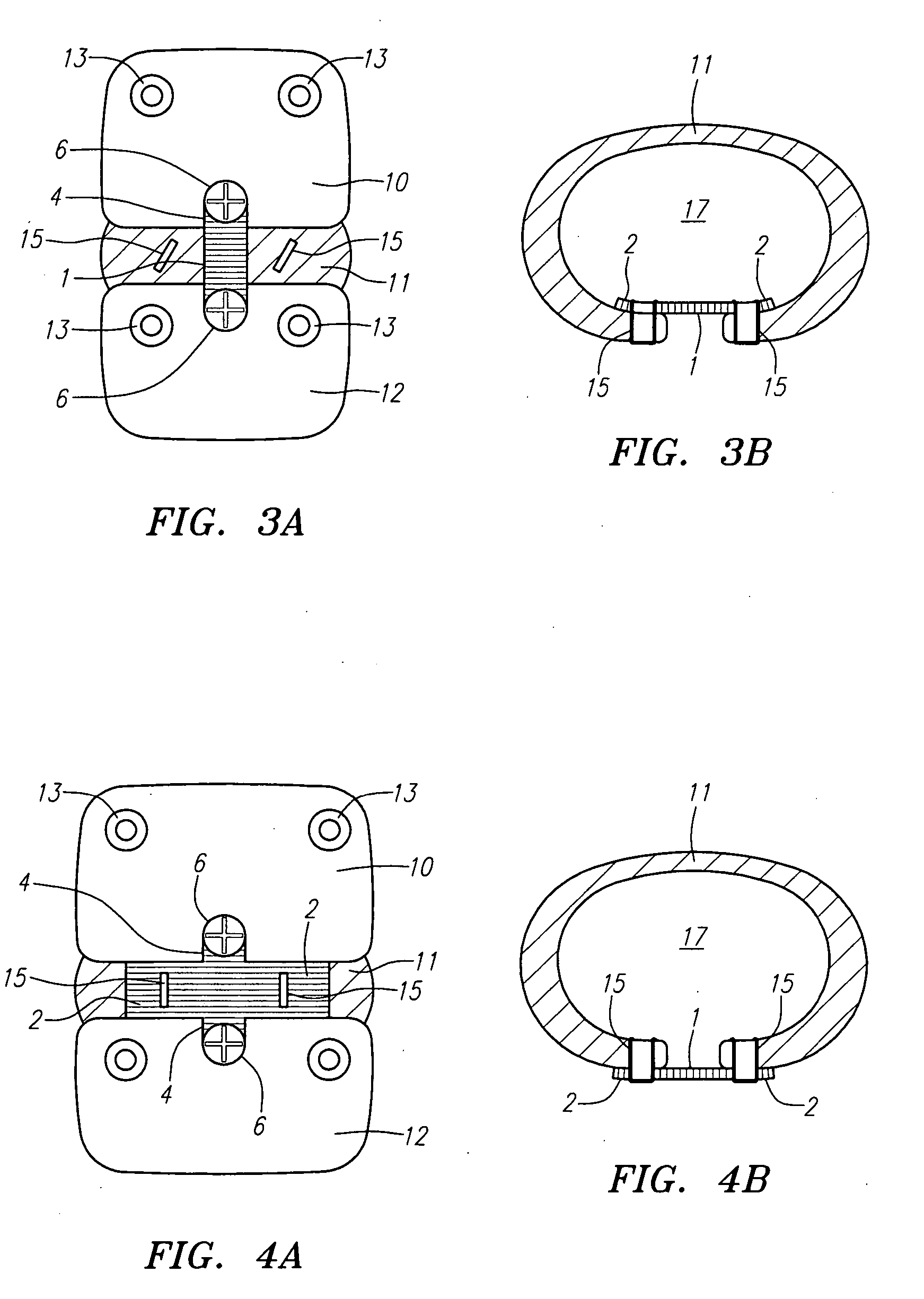 Methods and apparatus for reconstructing the annulus fibrosis