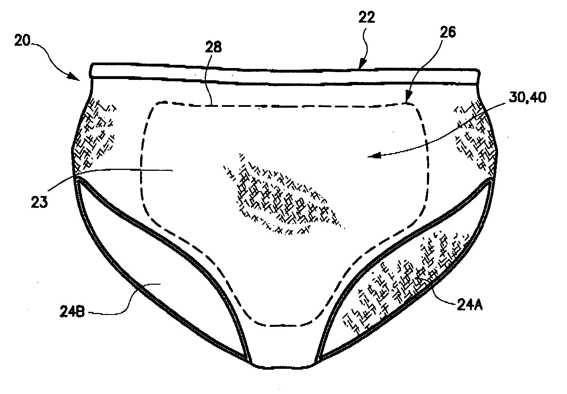 Post-cesarean section scar management undergarment