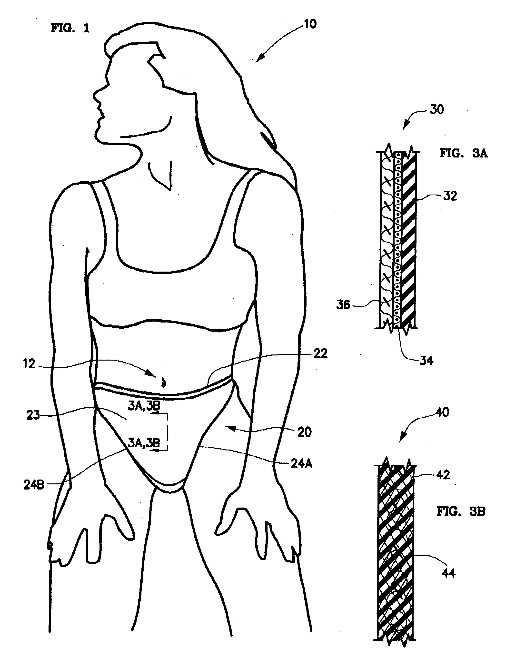 Post-cesarean section scar management undergarment