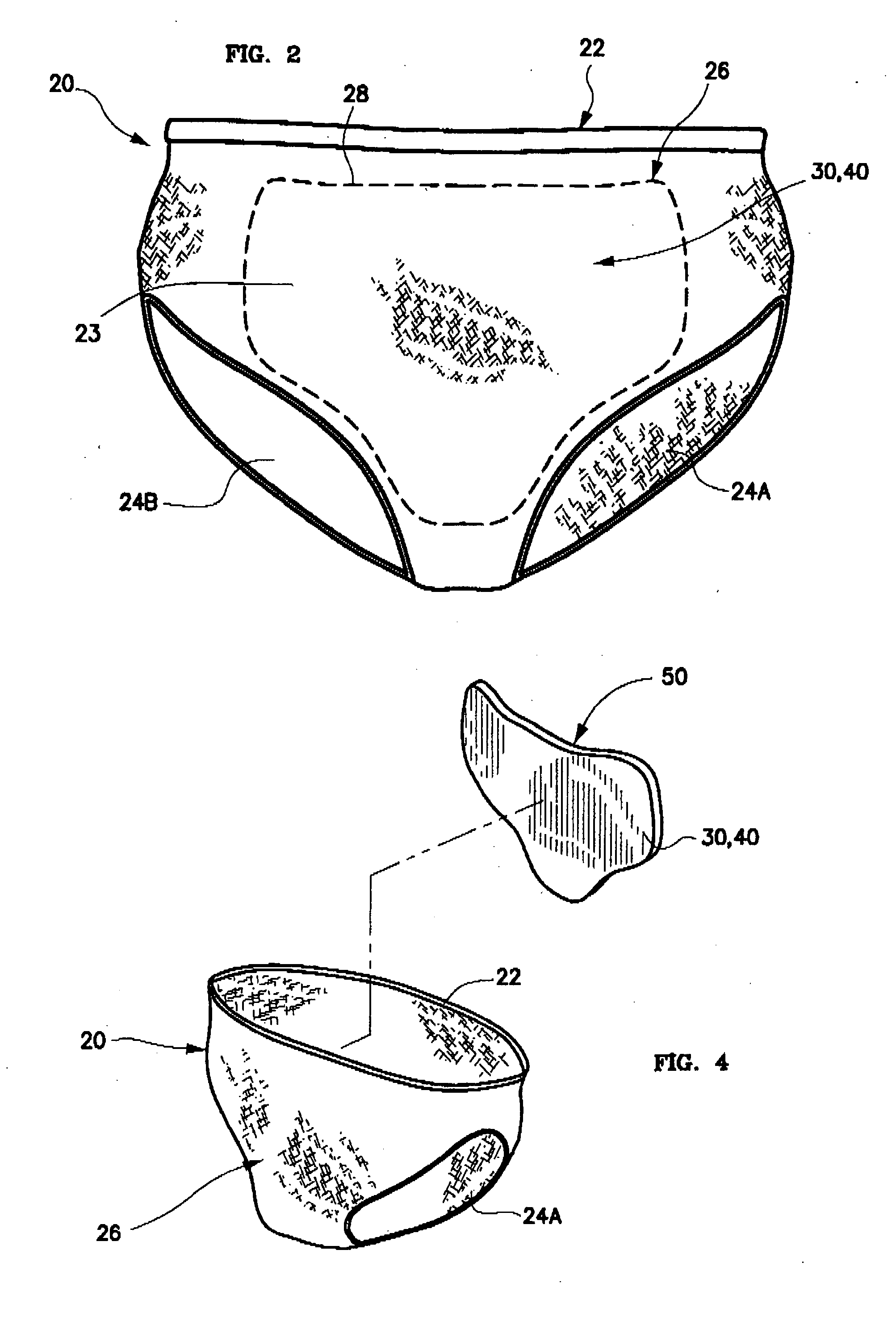 Post-cesarean section scar management undergarment