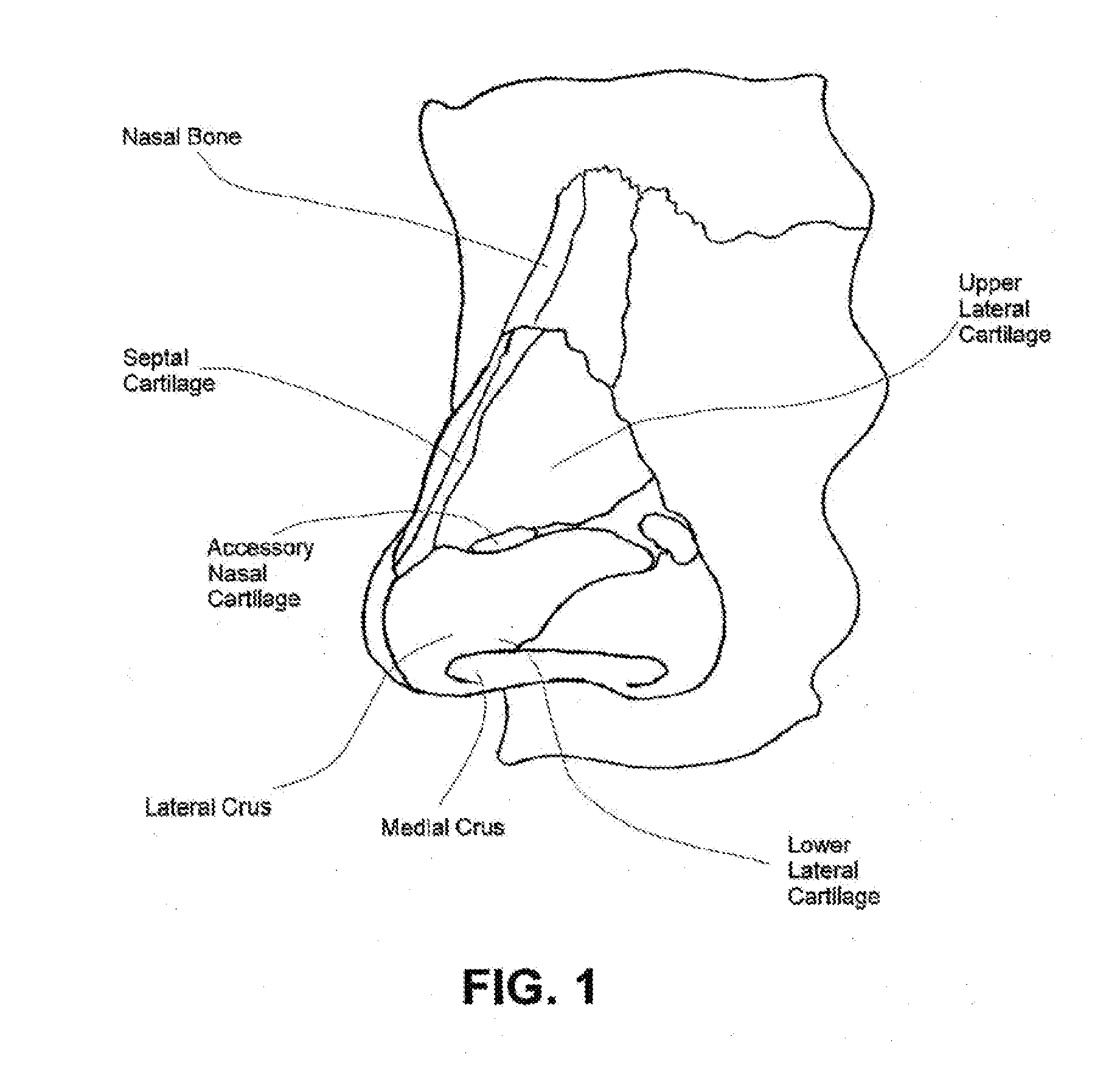 Methods and devices to treat nasal airways