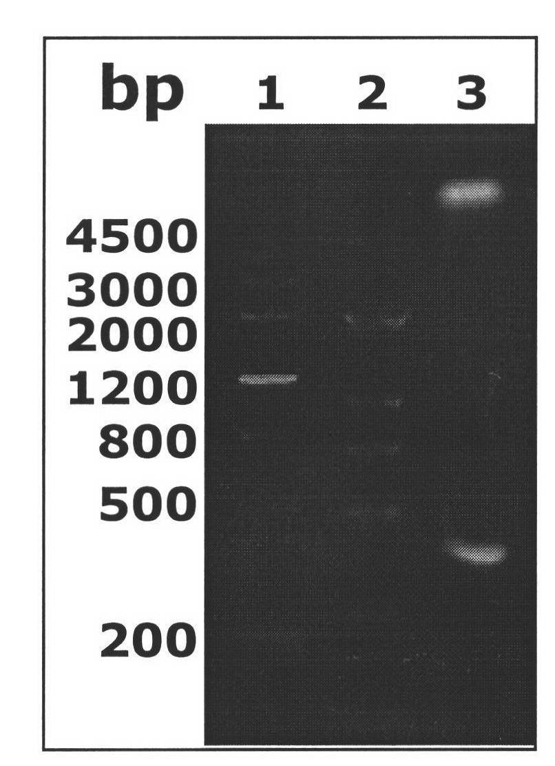 Helicobacter pylori epitope vaccine, design method thereof, preparation method thereof and application thereof