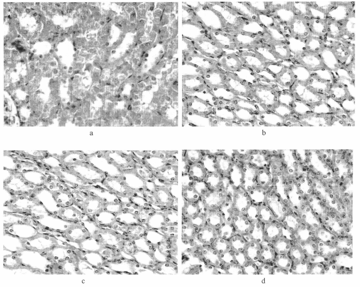 Artemisia rupestris preparation and application thereof in medicaments for treating diabetes