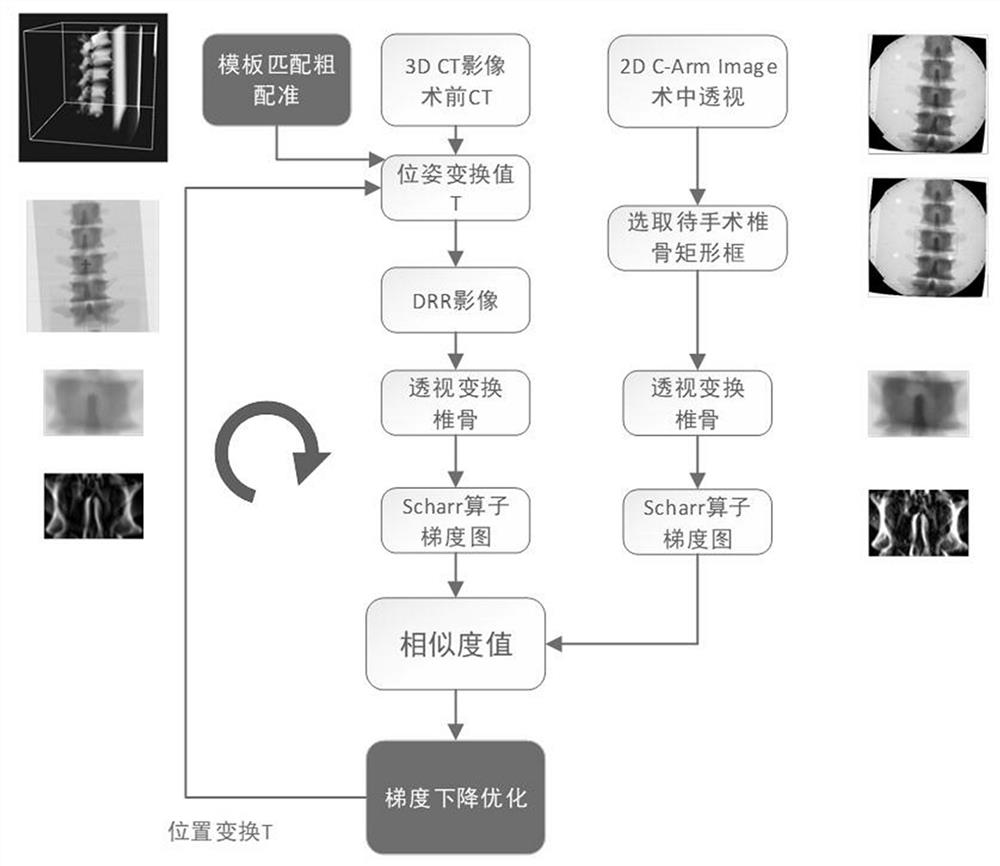 2D-3D image registration algorithm