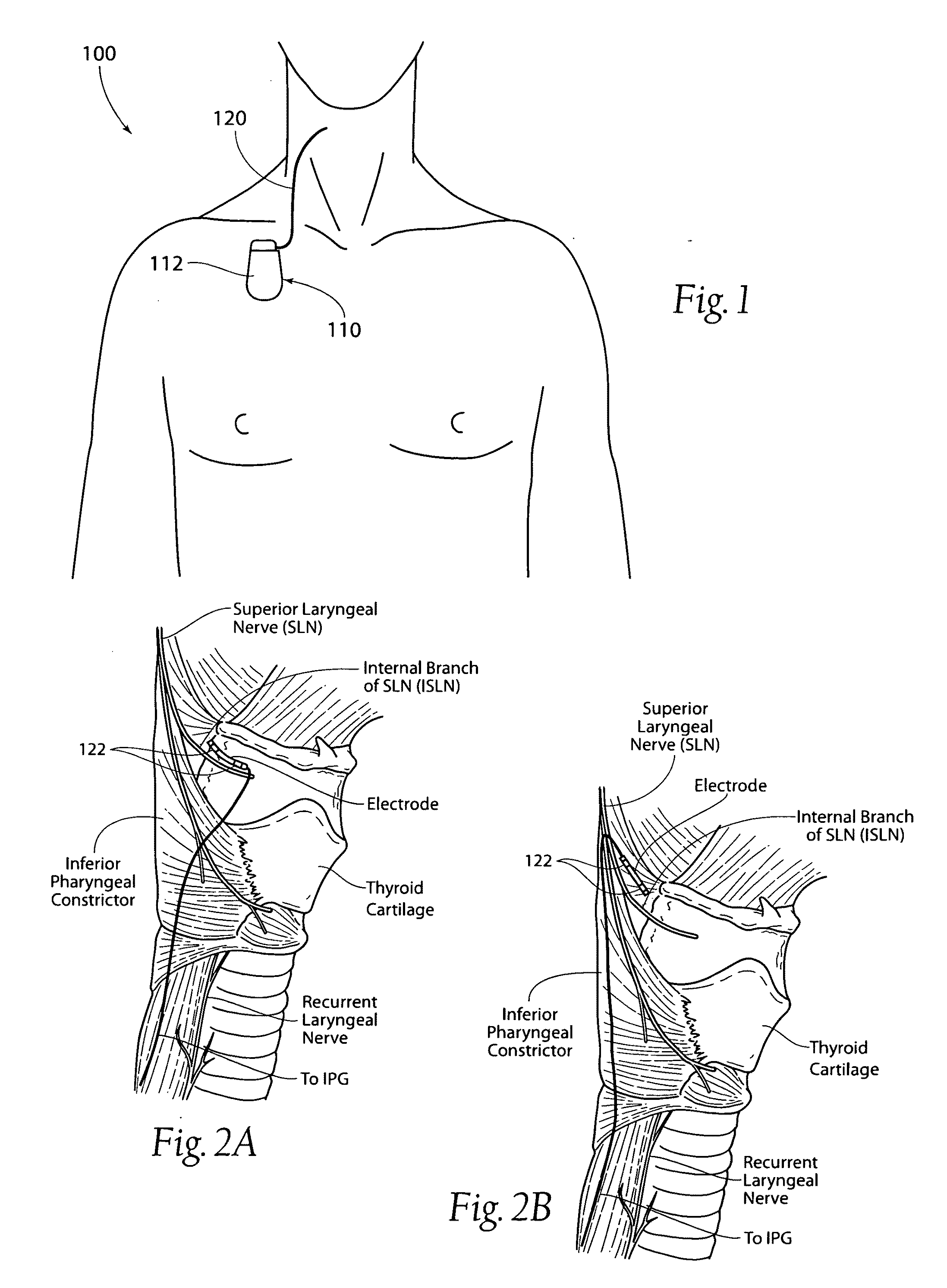 Systems and methods for maintaining airway patency