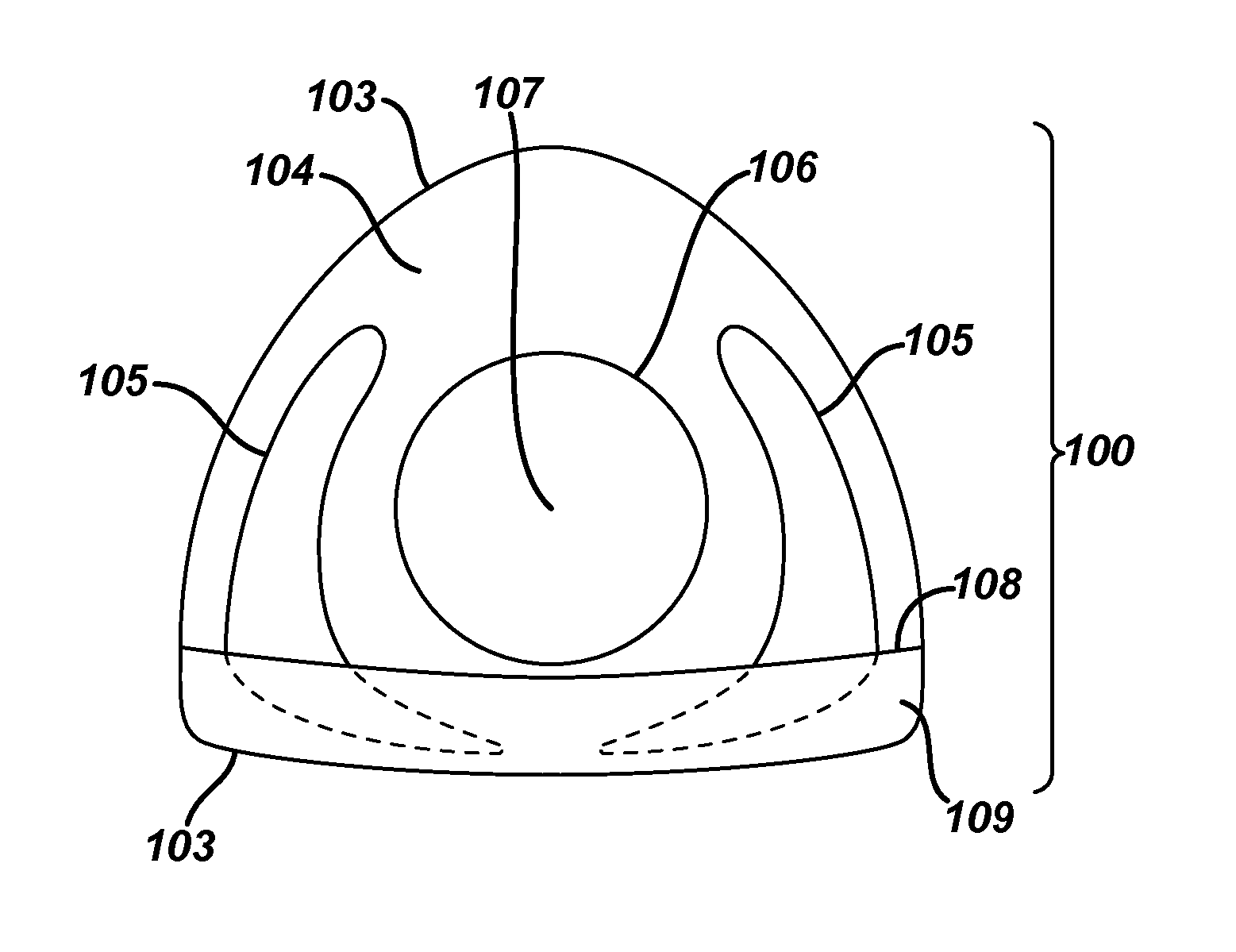 Methods and apparatus for forming a translating multifocal contact lens