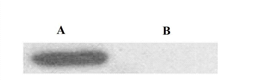 Preparation method of human cytokine-induced killer cells