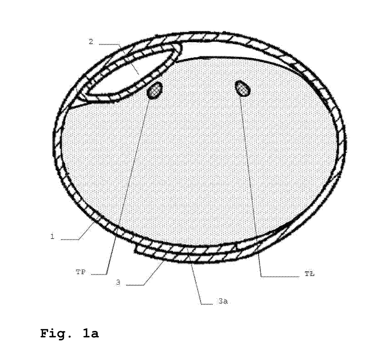 A method for automatic blood flow control, automatic blood flow control system and a tourniquet