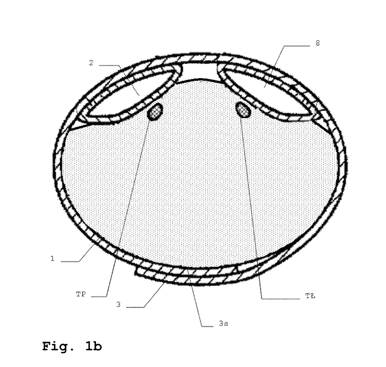 A method for automatic blood flow control, automatic blood flow control system and a tourniquet