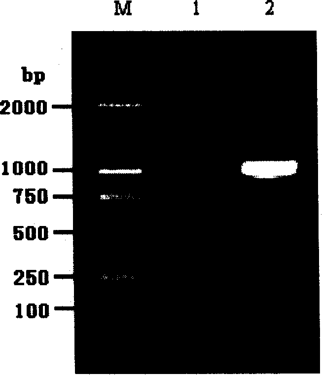 IL-12 expression carrier as well as eukaryotic cell strain expressed thereby and uses thereof