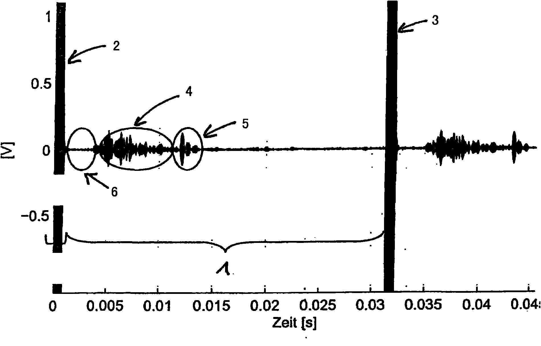 Method for dynamic calculation of noise levels