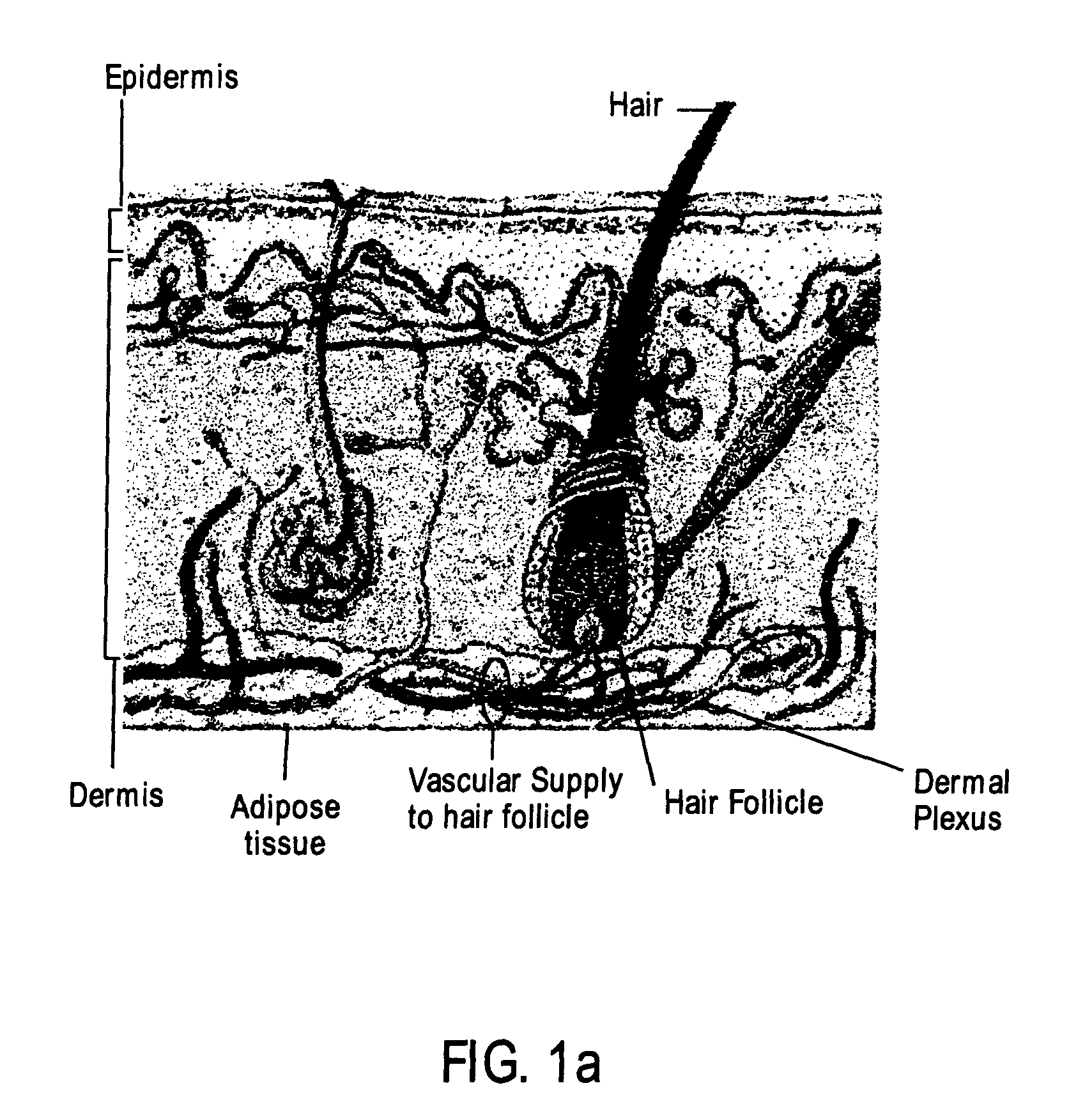 Apparatus and method having a cooling material and reduced pressure to treat biological external tissue