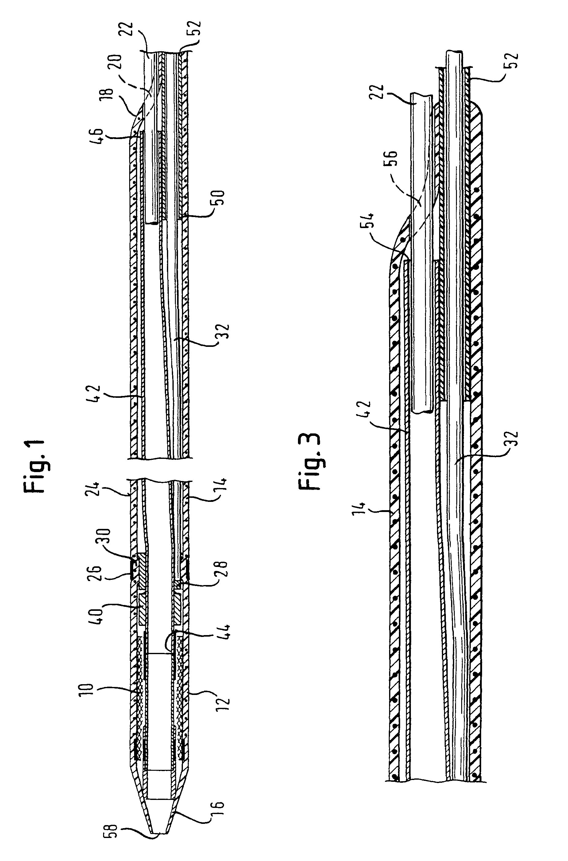 Catheter device