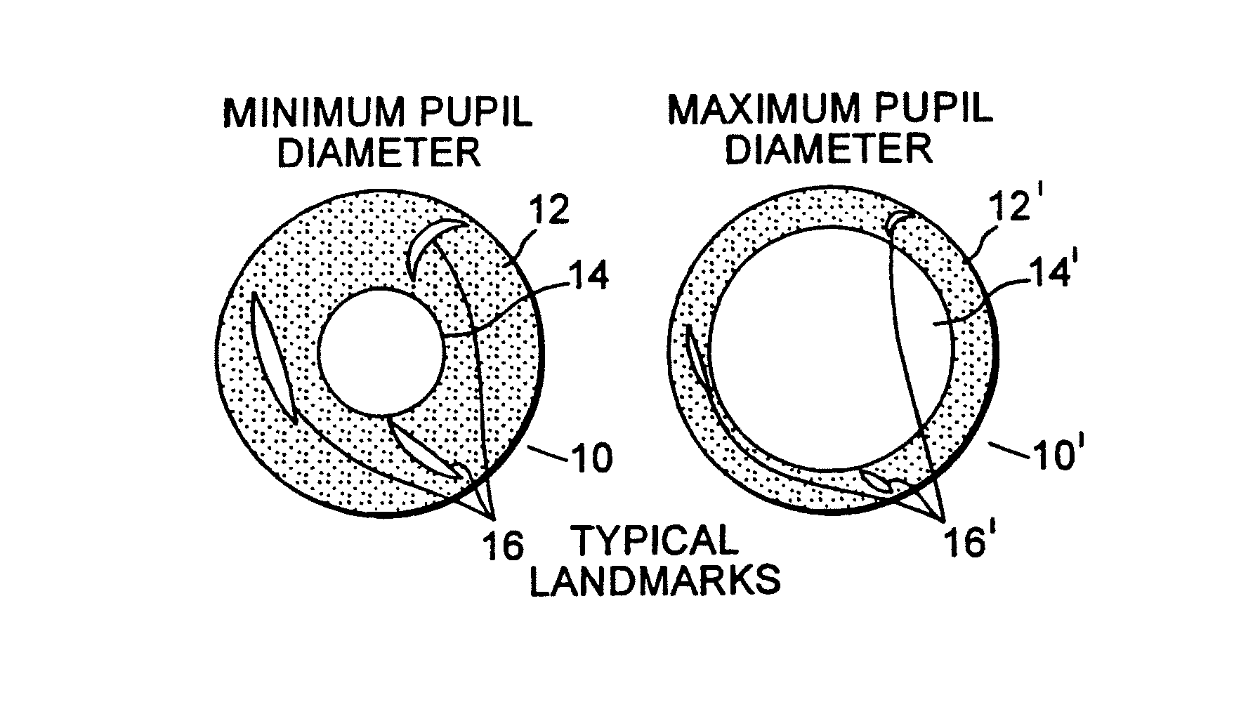 Iris pattern recognition and alignment