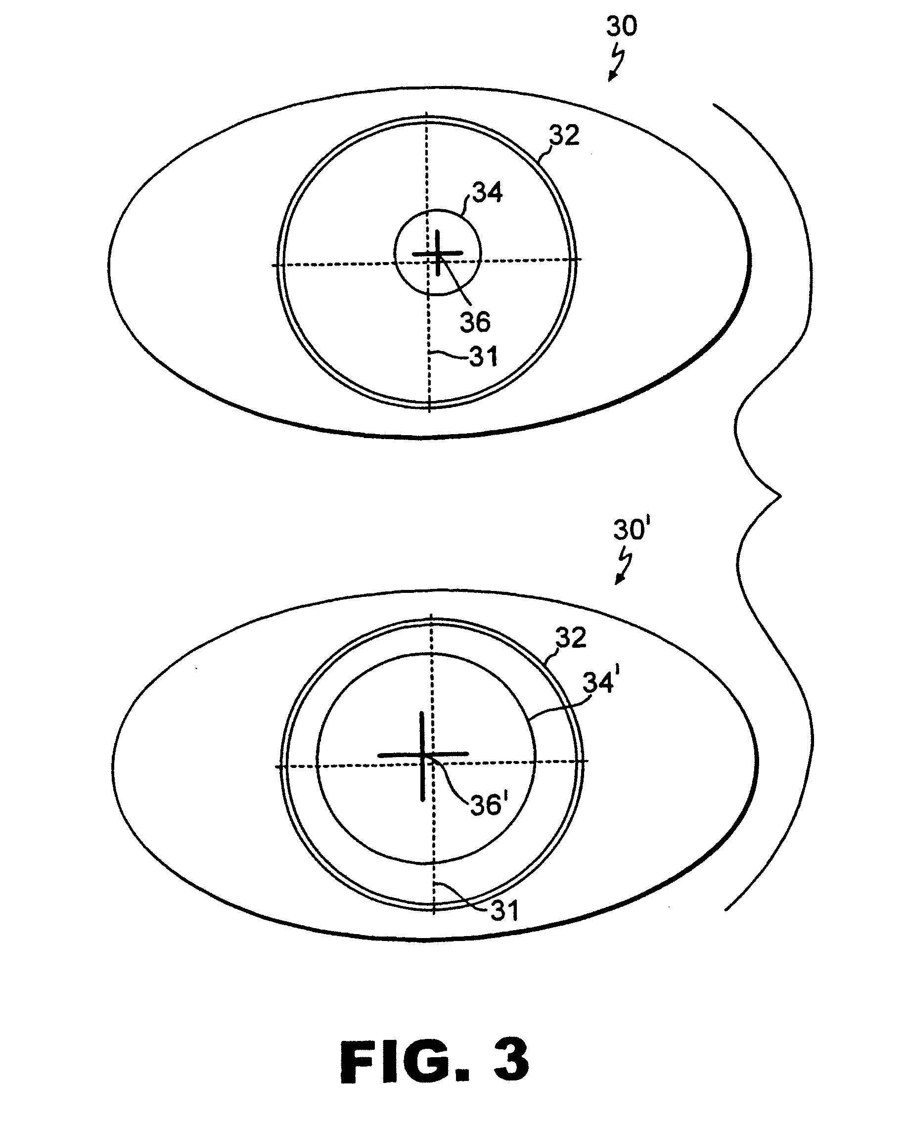 Iris pattern recognition and alignment