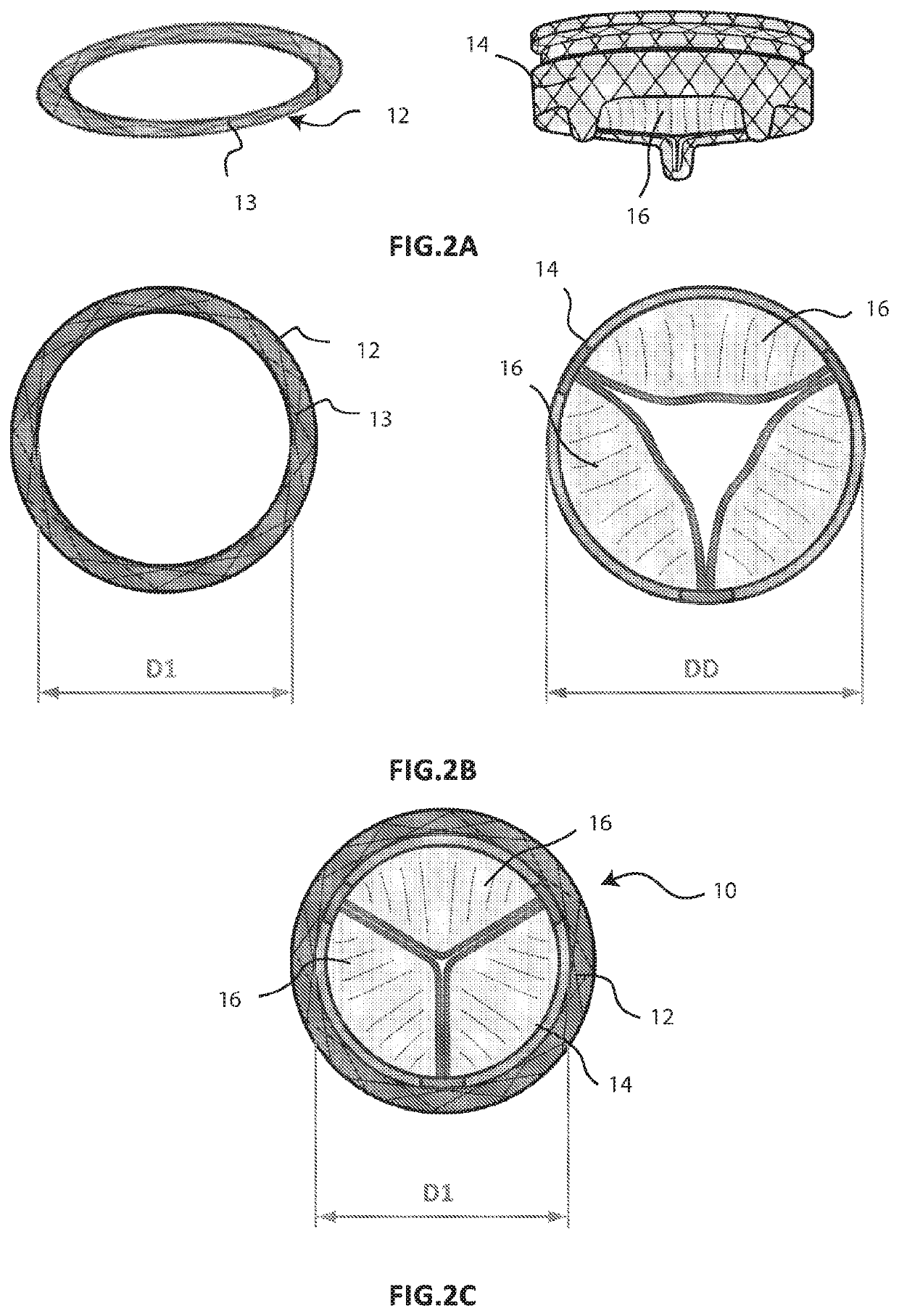 Cardiac valve prosthesis