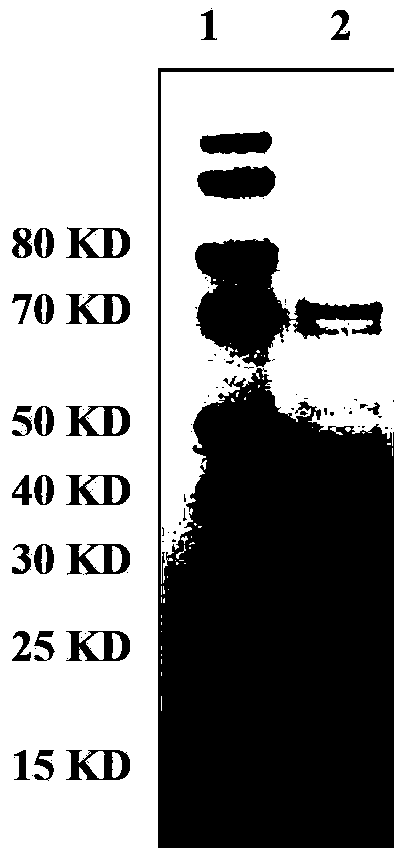 Human rotavirus Delta VP8* subunit recombinant protein and application thereof