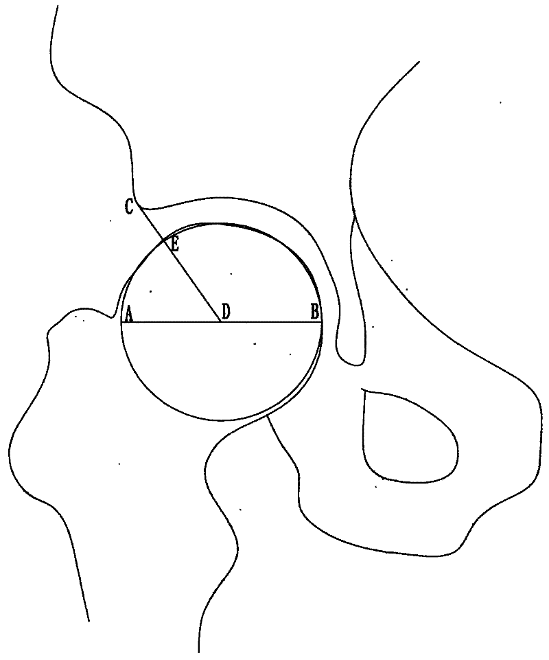 Measuring method of median load-bearing arc angle of hip joint