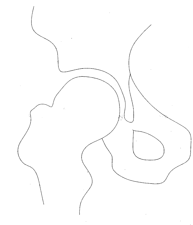 Measuring method of median load-bearing arc angle of hip joint