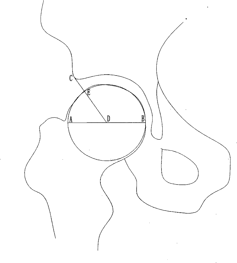 Measuring method of median load-bearing arc angle of hip joint