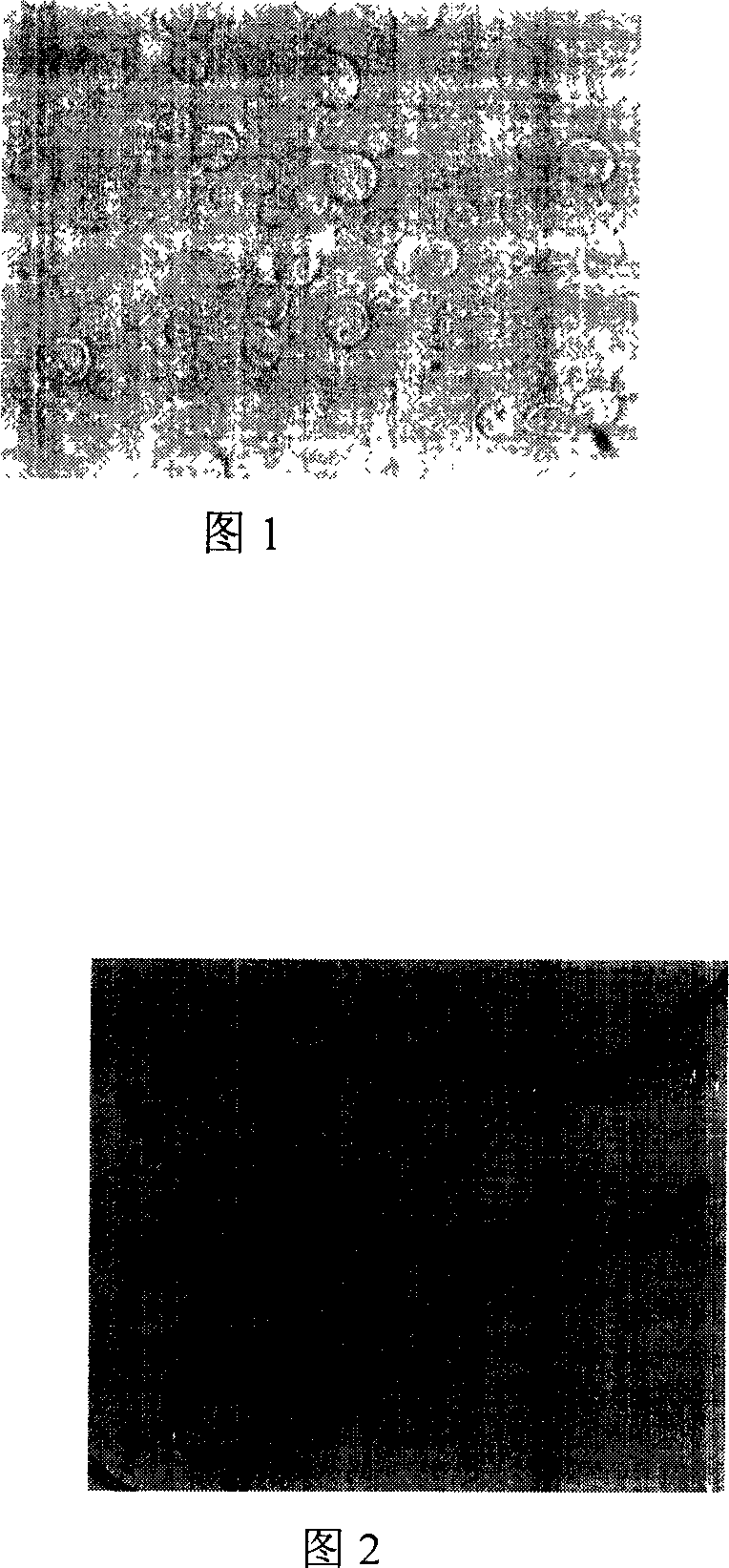 Separation of tropical candiyeast strain and production of xylitol