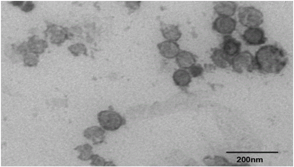 Functional lipidosome for treating brain tumor and preparing method and application thereof