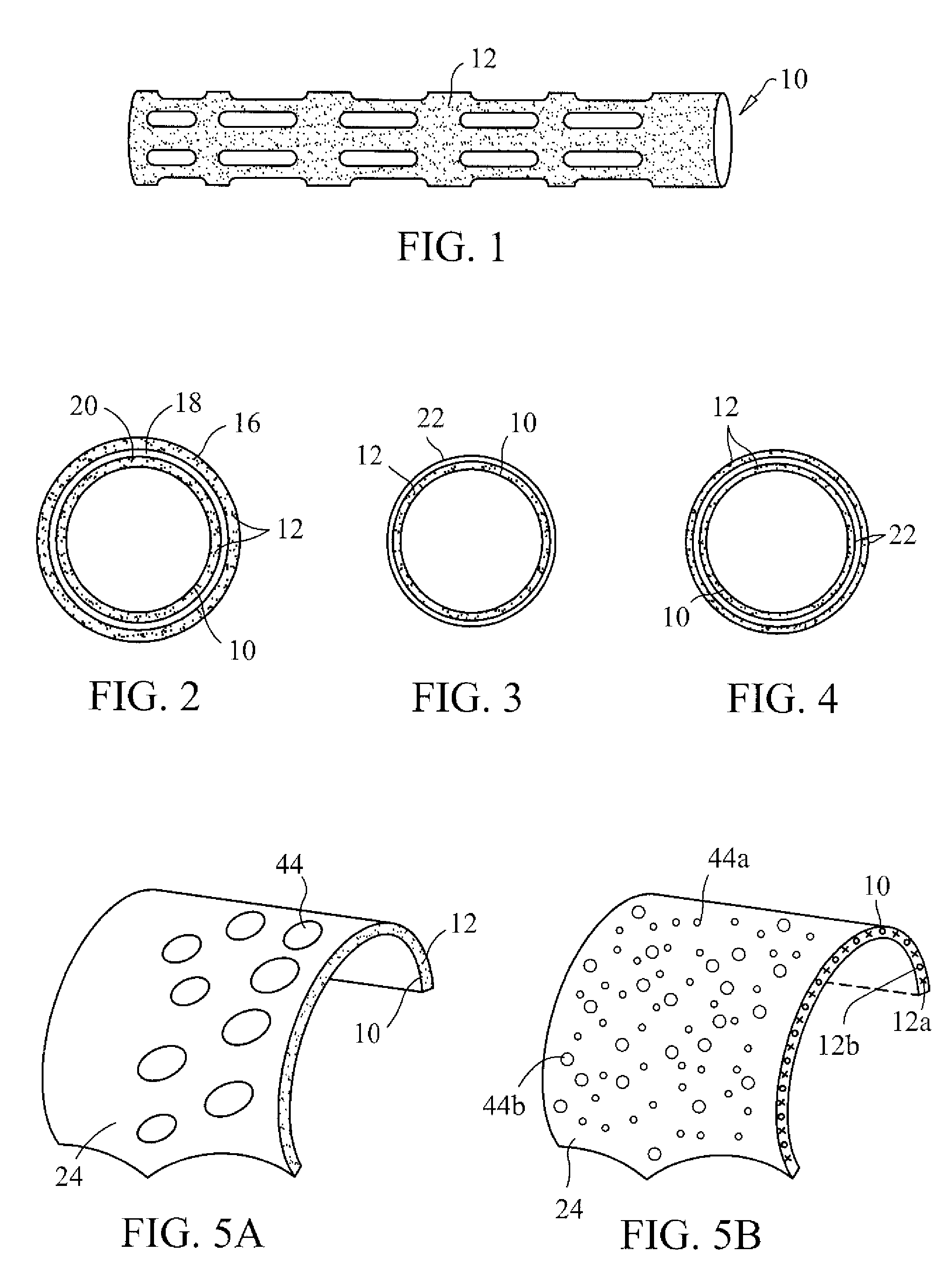 Drug eluting implant