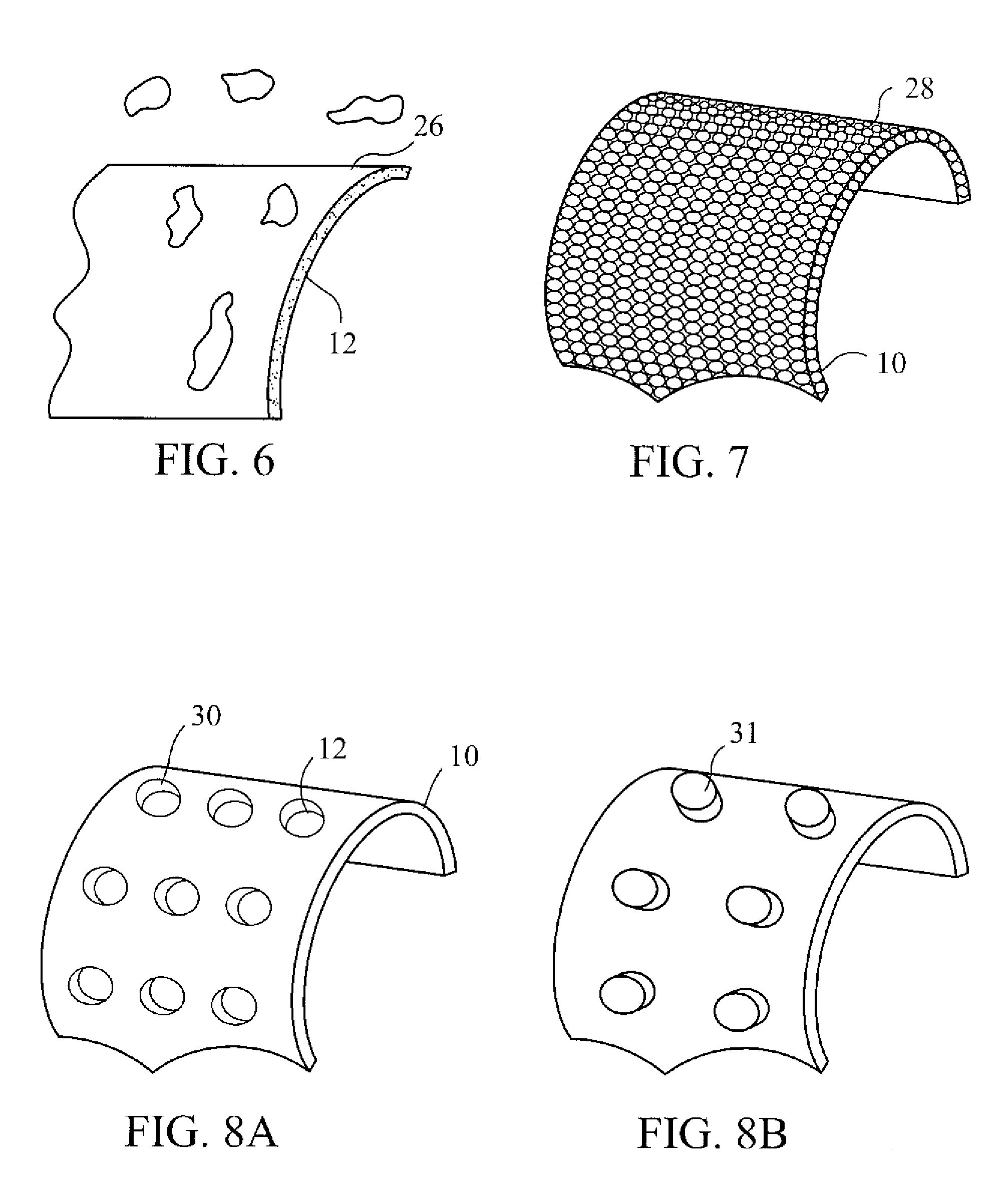 Drug eluting implant