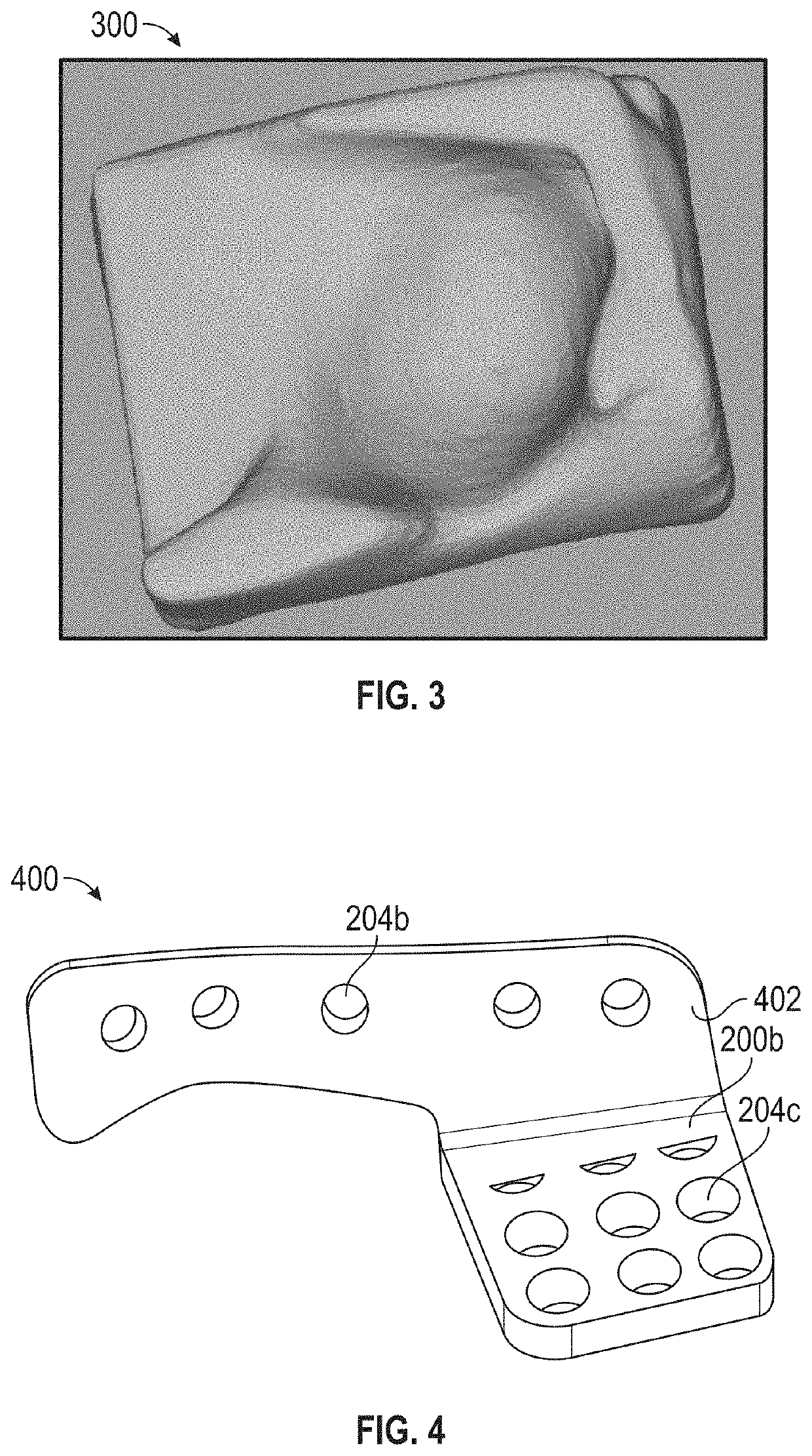 Implantable device for temporomandibular joint and method of production thereof