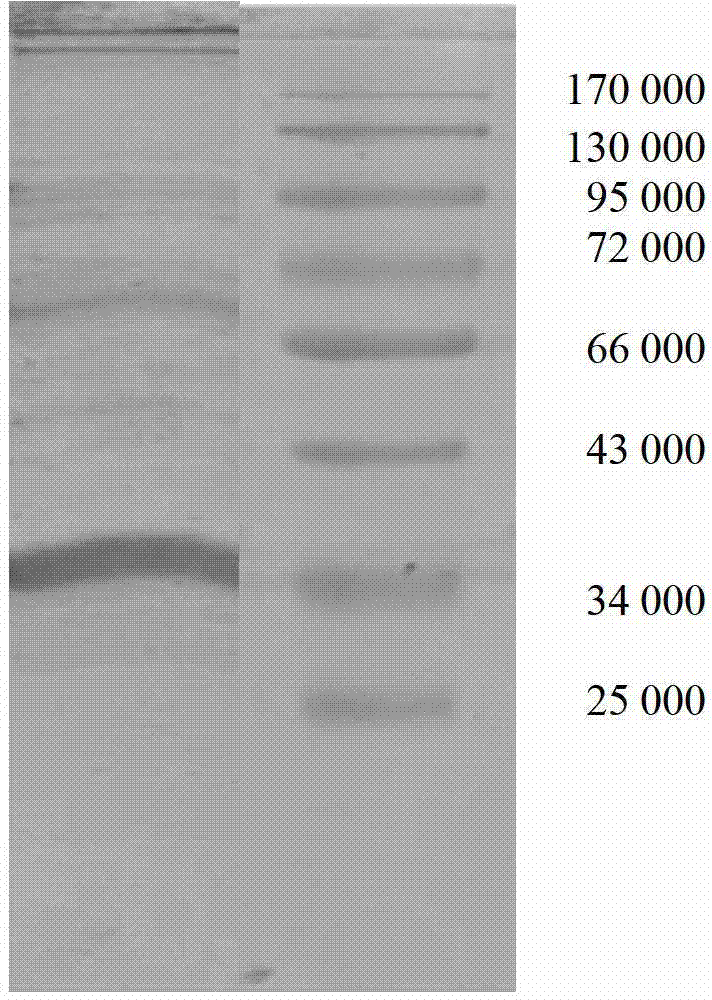 Biological reagent for treating carbapenems resistant acinetobacter baumannii infection