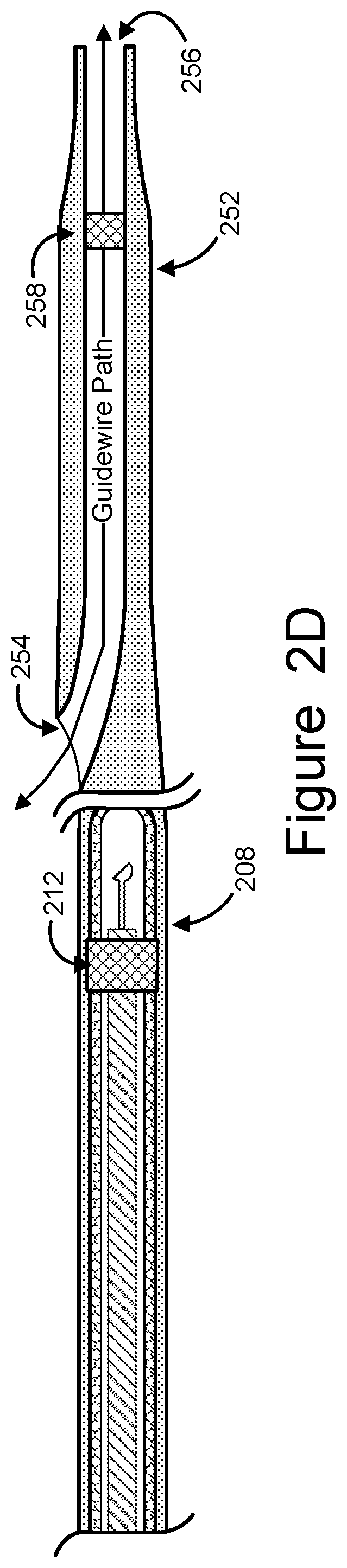 Apparatus, methods and computer-accessible media for in situ three-dimensional reconstruction of luminal structures