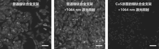 Memory alloy esophageal stent modified by nano copper sulfide coating and preparation method of memory alloy esophageal stent