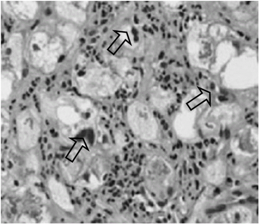 Construction method of cynomolgus macaque model for alcoholic liver disease